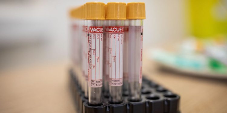 Brasil registra 10,9 mil novos casos de covid-19 em 24 horas