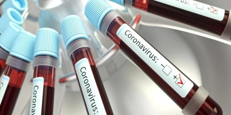 Brasil tem 95 suspeitas de reinfecção por coronavírus; descarte de testes dificulta análises