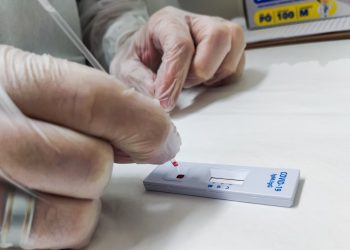 Demanda por teste de Covid em farmácia atinge novo pico e supera 1 milhão de exames