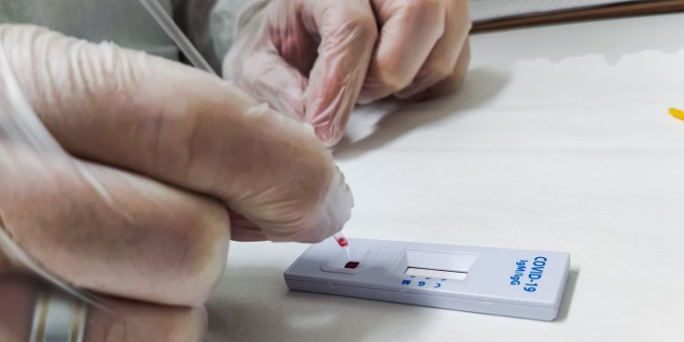Demanda por teste de Covid em farmácia atinge novo pico e supera 1 milhão de exames