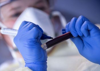 Média móvel chega a 586 mortes por covid-19 nos últimos 7 dias