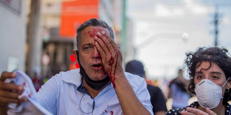 Atingidos por balas de borracha, dois homens perdem visão após ação da PM em ato contra Bolsonaro no Recife