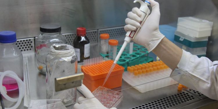 Pesquisadores desenvolvem testes rápidos para diagnóstico de covid-19
