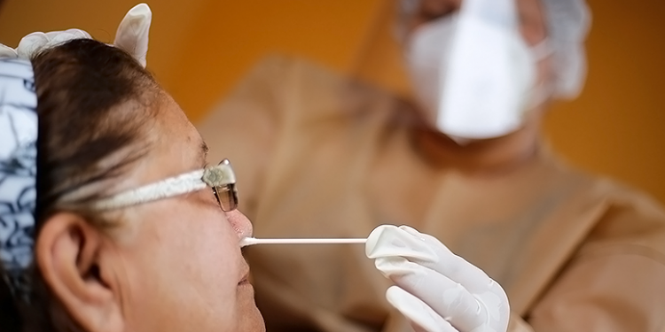 Referência em diagnóstico da Covid-19, Lacen soma mais de 500 mil exames RT-PCR desde início da pandemia
