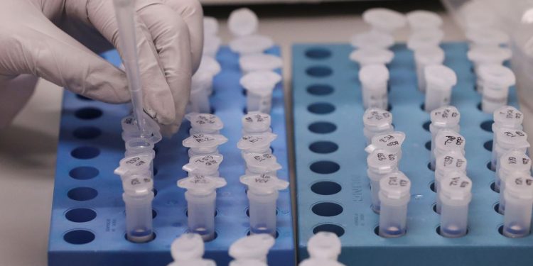Uece desenvolve teste de detecção da Covid pela saliva rápido e eficaz
