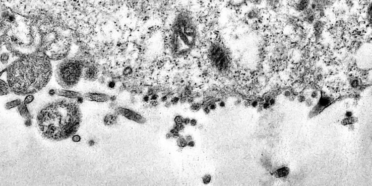 Pesquisa mostra marcadores genéticos associados à covid-19