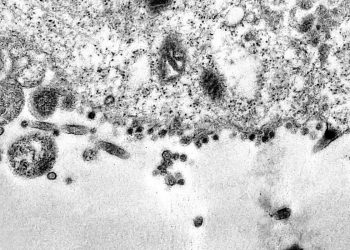 Pesquisadores desenvolvem equipamento para capturar coronavírus