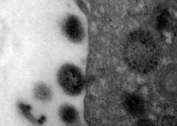 Fiocruz alerta que SRAG pode voltar a crescer