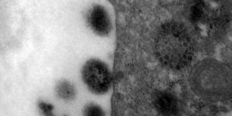 Fiocruz alerta que SRAG pode voltar a crescer