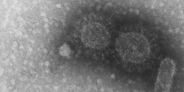 Brasil registra 570 casos de infecção pela variante Delta