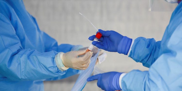 Ceará chega a 62 casos da variante Delta