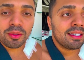 Tirullipa sofre acidente de moto e passa por cirurgia