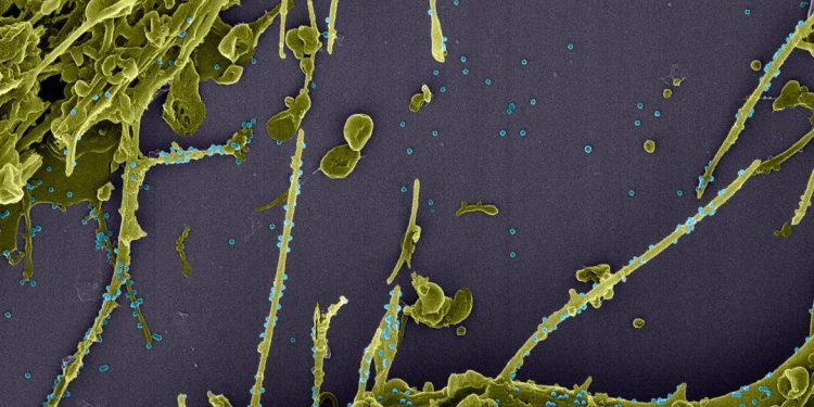 Anvisa recomenda restrições de voo diante de nova variante de covid-19