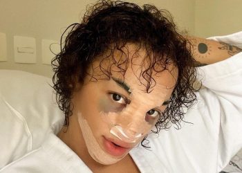 Pabllo Vittar publica foto após rinoplastia e diz adorar ‘intervençãozinha’