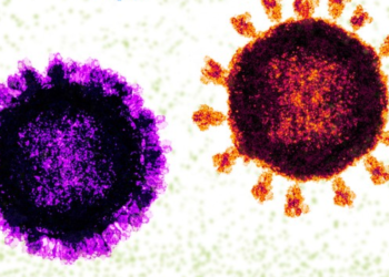 “Flurona”: especialista fala sobre infecção de COVID-19 e Influenza em conjunto