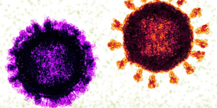 “Flurona”: especialista fala sobre infecção de COVID-19 e Influenza em conjunto