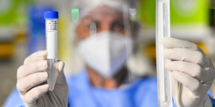 Sesc Ler Aracati será ponto de testagem para a Covid-19 a partir desta segunda (24)