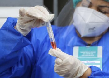 Com novos cinco pontos de testagem gratuita no Senac, Ceará soma 25 locais com o serviço