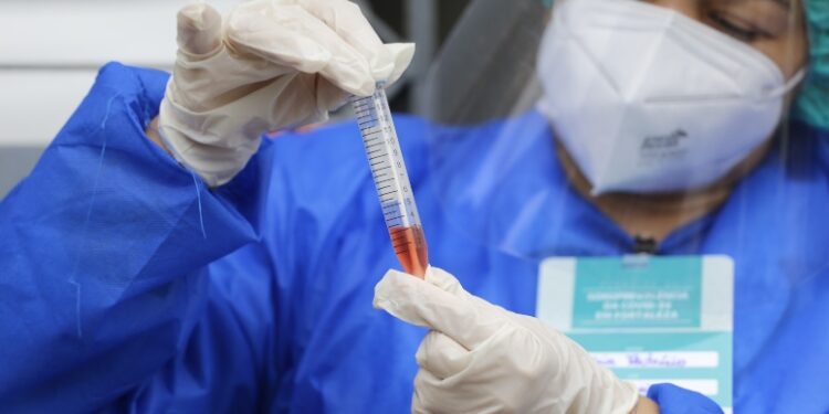 Com novos cinco pontos de testagem gratuita no Senac, Ceará soma 25 locais com o serviço