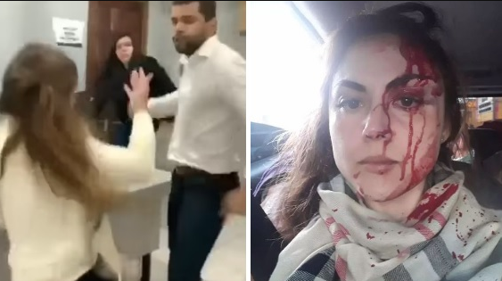 Procurador que agrediu colega é preso no interior de SP