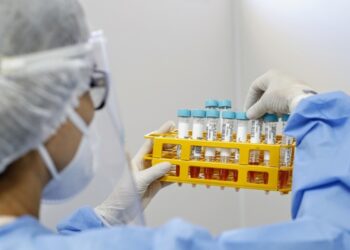 Em parceria com o Sesi, Saúde do Ceará abre três novos pontos de testagem gratuita