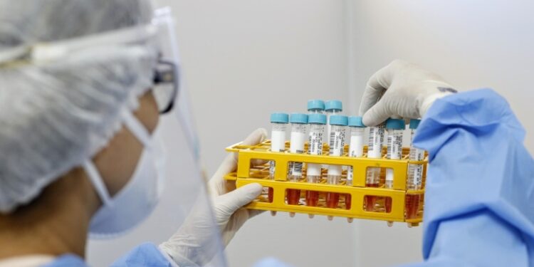 Em parceria com o Sesi, Saúde do Ceará abre três novos pontos de testagem gratuita