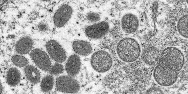 Ministério da Saúde monitora sete casos suspeitos de varíola dos macacos no Brasil