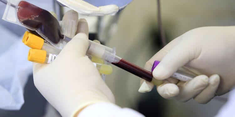 Varíola dos macacos: Anvisa faz recomendações sobre doação de sangue