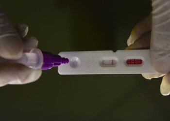 Brasil registra 18,5 mil novos casos e 53 mortes por covid-19