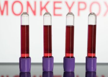 Varíola dos macacos: entidades criticam estigma a homossexuais