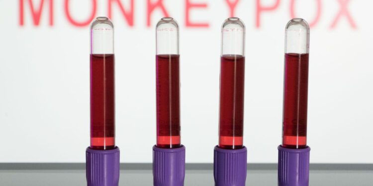 Varíola dos macacos: entidades criticam estigma a homossexuais