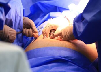 Mais de 679 mil pessoas no Brasil aguardam em filas de cirurgias eletivas