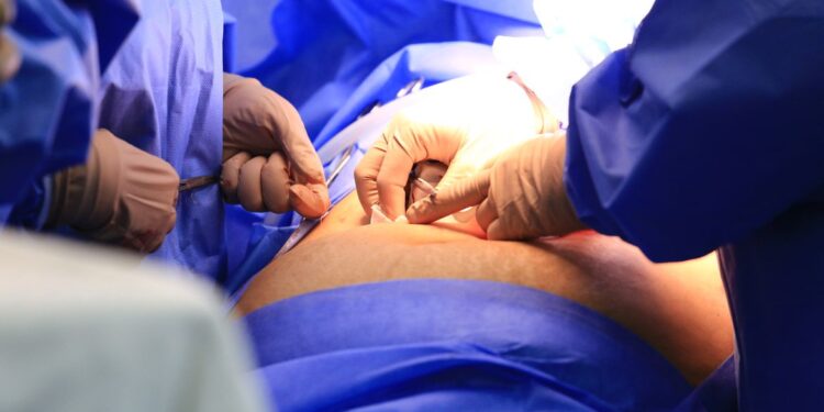 Mais de 679 mil pessoas no Brasil aguardam em filas de cirurgias eletivas