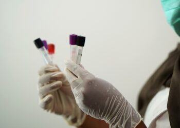 Aracati realiza coleta de exames nas UBSs distantes da sede