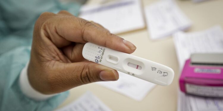 Positividade de testes de covid-19 subiu de 4% para 13%, diz UFRJ