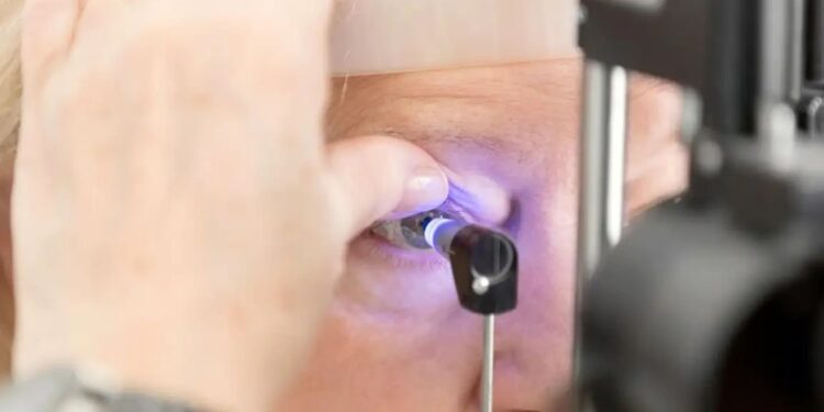 Perda de visão por intoxicação com metanol persiste por anos, e chances de reversão são pequenas