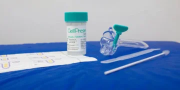 Guia orienta sobre mudança no rastreamento do câncer de colo do útero