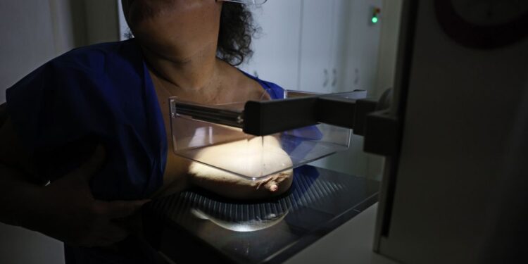 Vigitel: 92% das brasileiras entre 50 e 69 anos fizeram mamografia
